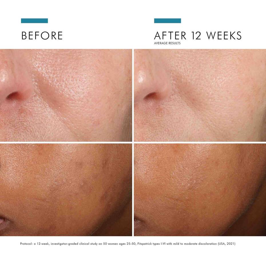 SkinCeuticals-Phloretin CF