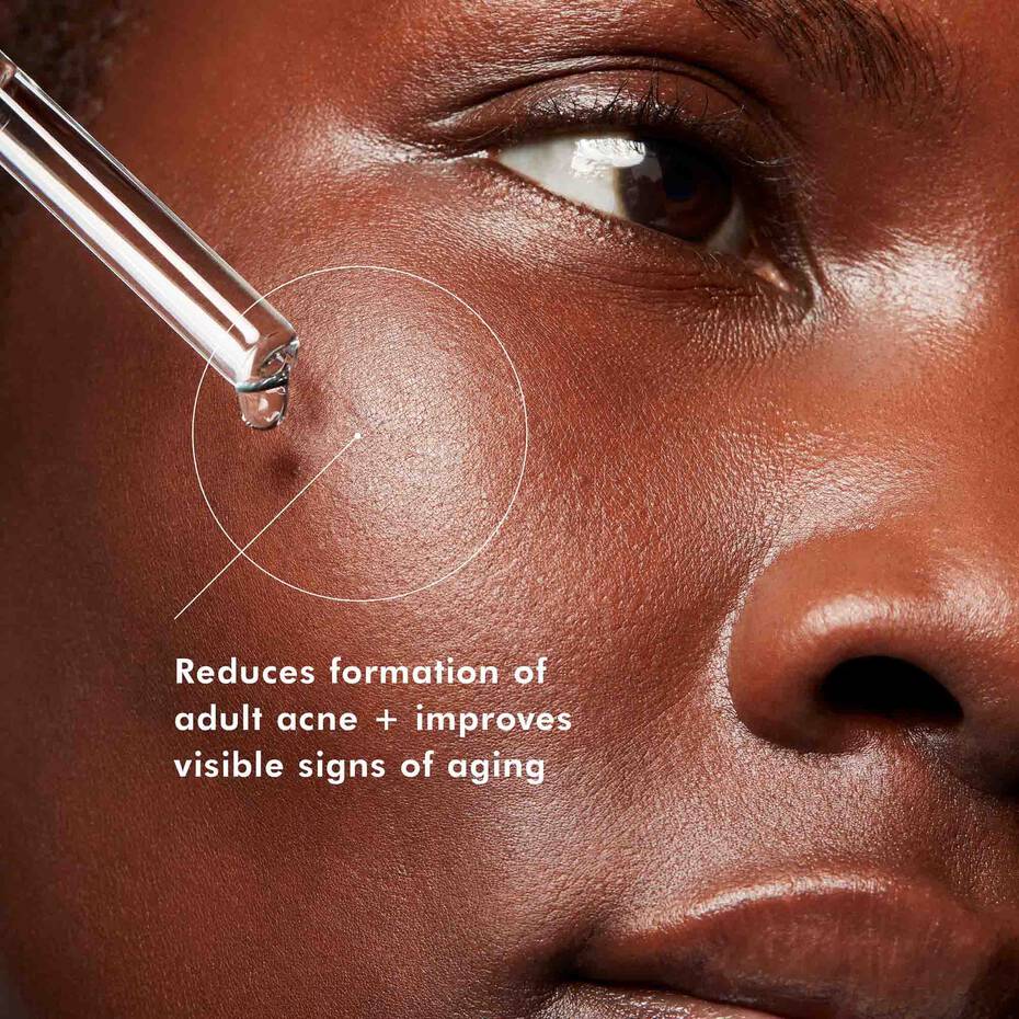 SkinCeuticals Blemish Age Defense